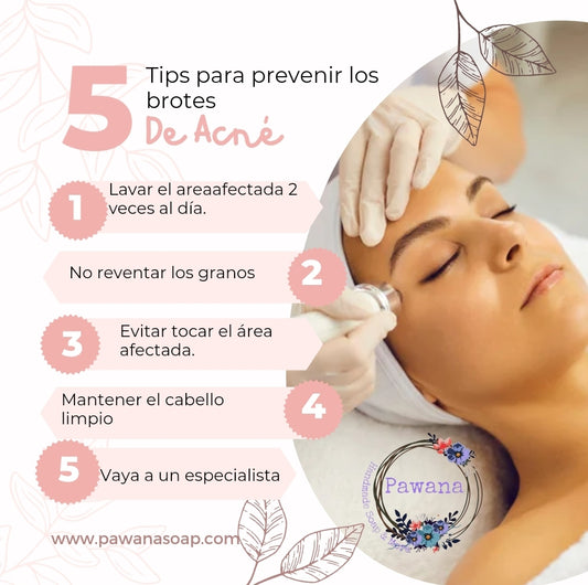 5 Tips para prevenir los brotes de Acné