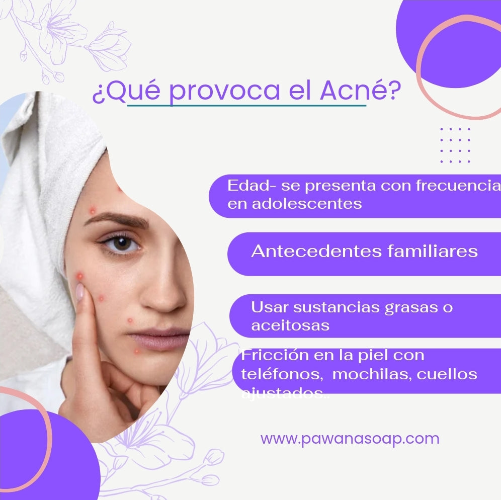 ¿Qué provoca el Acné?
