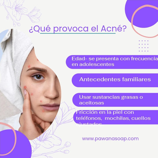 ¿Qué provoca el Acné?